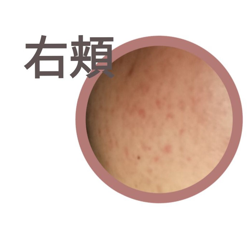 ハトムギ化粧水(ナチュリエ スキンコンディショナー R )/ナチュリエ/化粧水を使ったクチコミ（2枚目）