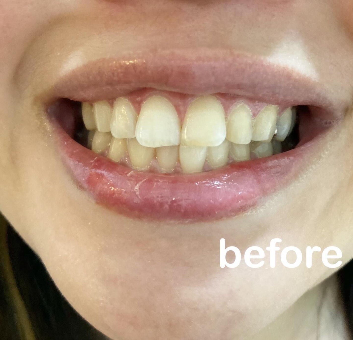 歯磨き堂 薬用ホワイトニングペースト プレミアム/歯磨き堂/歯磨き粉を使ったクチコミ(3枚目)