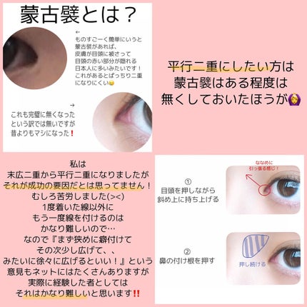 ワンダーアイリッドテープ Extra/D-UP/二重まぶた用アイテムを使ったクチコミ(9枚目)