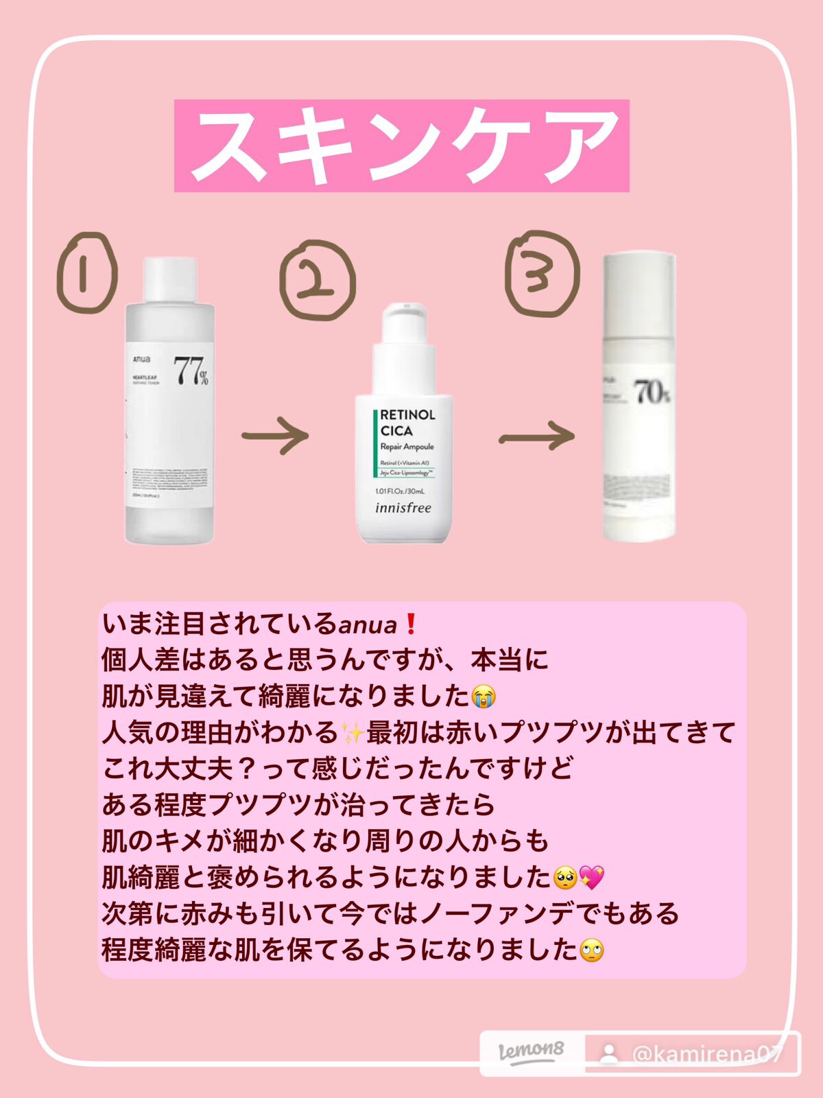 ドクダミ 77 スージングトナー/Anua/化粧水を使ったクチコミ(4枚目)