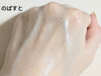 オイデルミン エッセンスローション/SHISEIDO/化粧水を使ったクチコミ(9枚目)