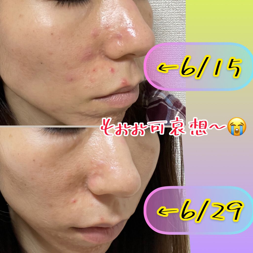 デュオ ザ クレンジングバーム ホワイトa/DUO/クレンジングバームを使ったクチコミ(3枚目)