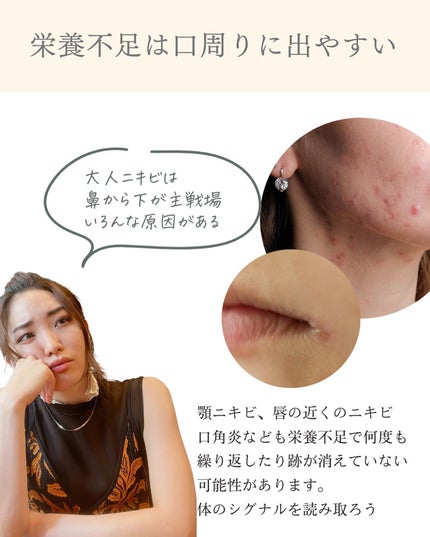 おゆみ|ニキビ・ニキビ跡ケア on LIPS 「【どんだけ大事なの、鉄…】こんばんは。おゆみです。鉄の重要性、..」(6枚目)