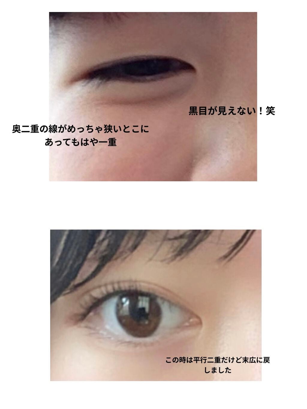 ワンダーアイリッドテープ Extra/D-UP/二重まぶた用アイテムを使ったクチコミ(5枚目)