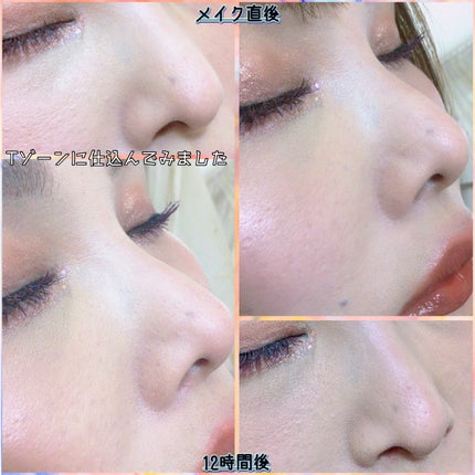 Vビームセラム/benilla/美容液を使ったクチコミ(3枚目)