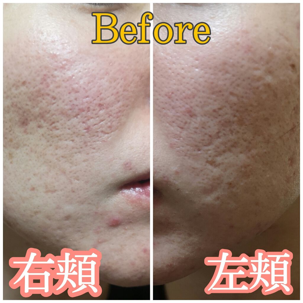 高浸透保湿マスク/SQS/シートマスク・パックを使ったクチコミ（3枚目）