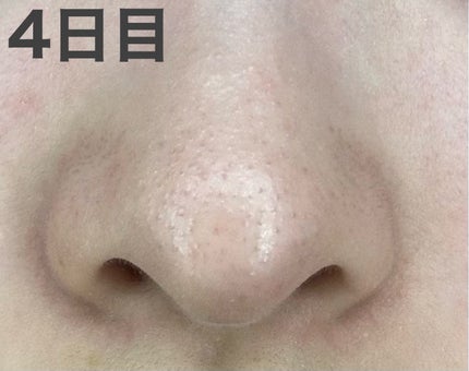 ロゼット洗顔パスタ ブラックパール/ロゼット/洗顔フォームを使ったクチコミ(2枚目)