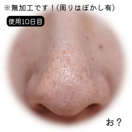 タカミスキンピール/タカミ/ブースター・導入液を使ったクチコミ(8枚目)
