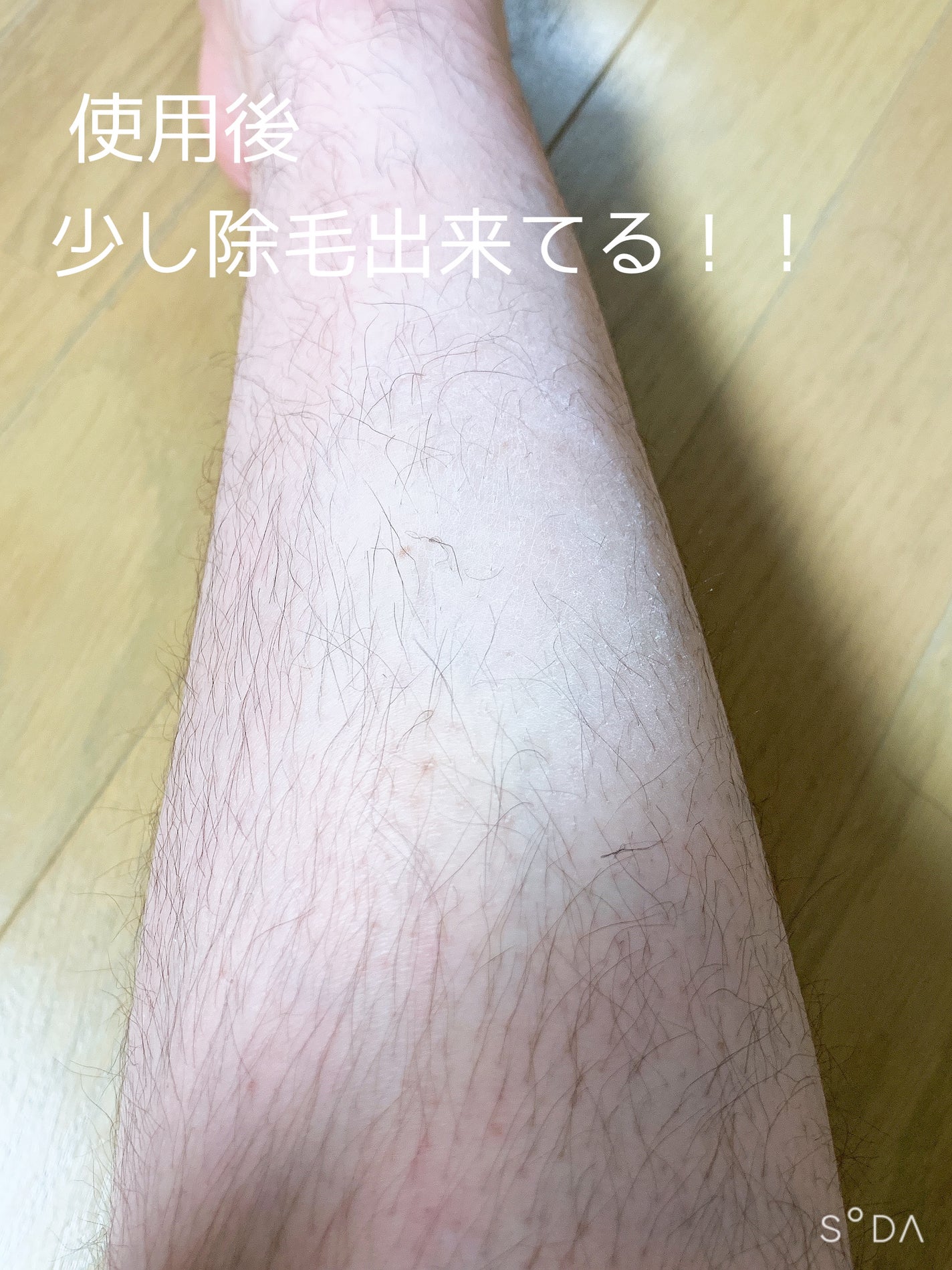 つるすべ除毛パッド/DAISO/ムダ毛ケアを使ったクチコミ(3枚目)