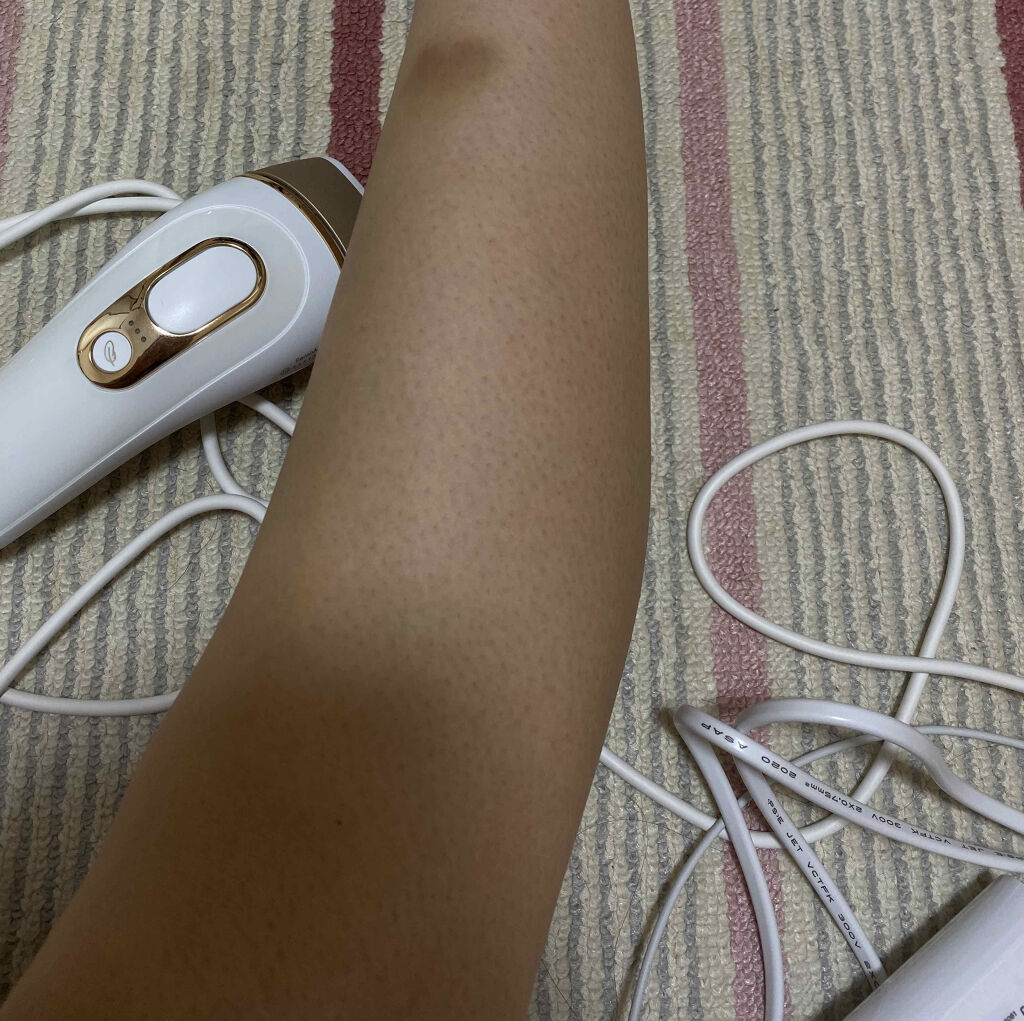 ブラウンシルクエキスパート （光美容器）/ブラウン/家庭用脱毛器を使ったクチコミ（1枚目）