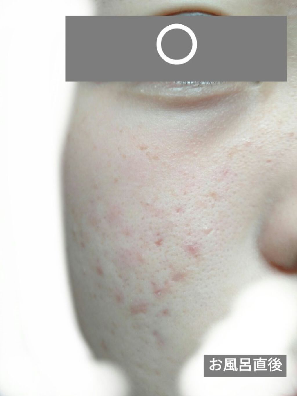 ミルキュア ピュア ウォッシュ&パウダー/ハウス オブ ローゼ/洗顔パウダーを使ったクチコミ(5枚目)