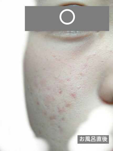 ミルキュア ピュア ウォッシュ&パウダー/ハウス オブ ローゼ/洗顔パウダーを使ったクチコミ(5枚目)