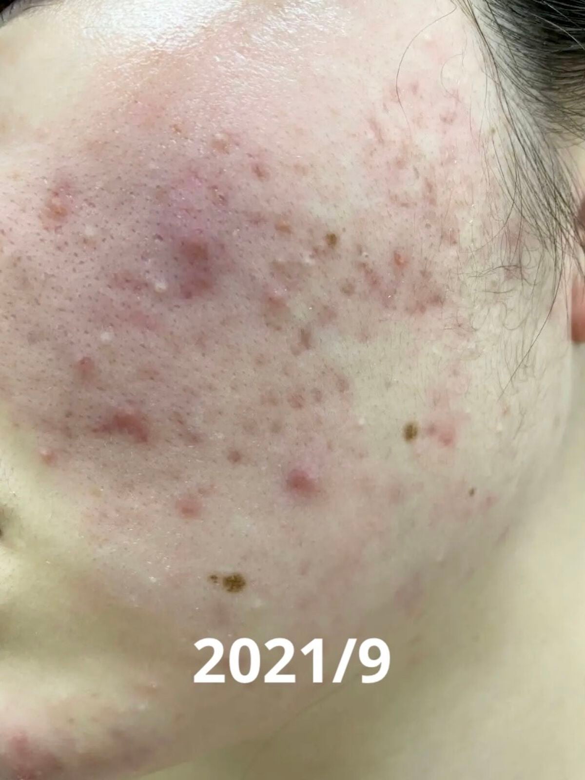 菊正宗 日本酒の化粧水 高保湿/菊正宗/化粧水を使ったクチコミ(2枚目)