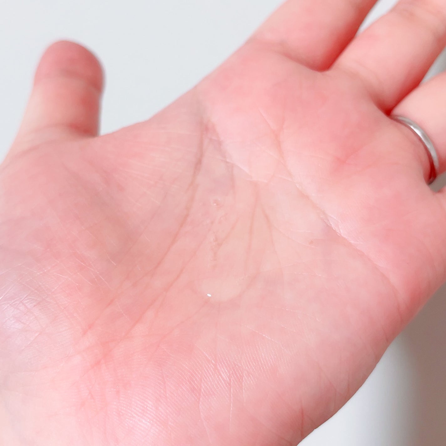 VIO TREATMENT LOTION/iroha INTIMATE CARE/デリケートゾーンケアを使ったクチコミ(2枚目)