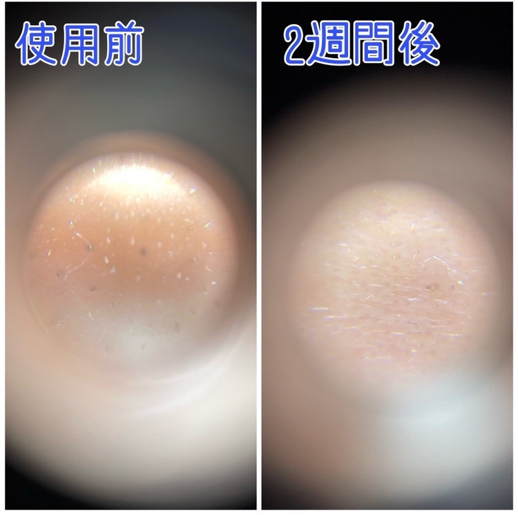 yucca on LIPS 「正直レビュー🙌【リードルショット100】【リードルショットシナ..」(5枚目)