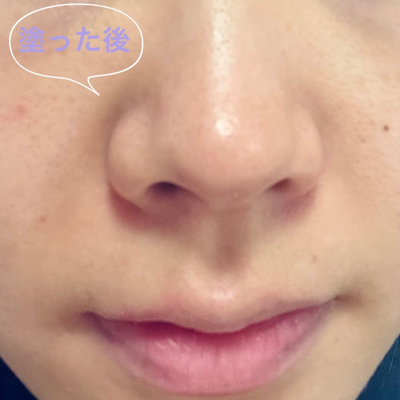 レチノール スーパーバウンス セラム/IOPE/美容液を使ったクチコミ(4枚目)