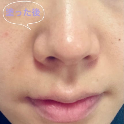 レチノール スーパーバウンス セラム/IOPE/美容液を使ったクチコミ(4枚目)