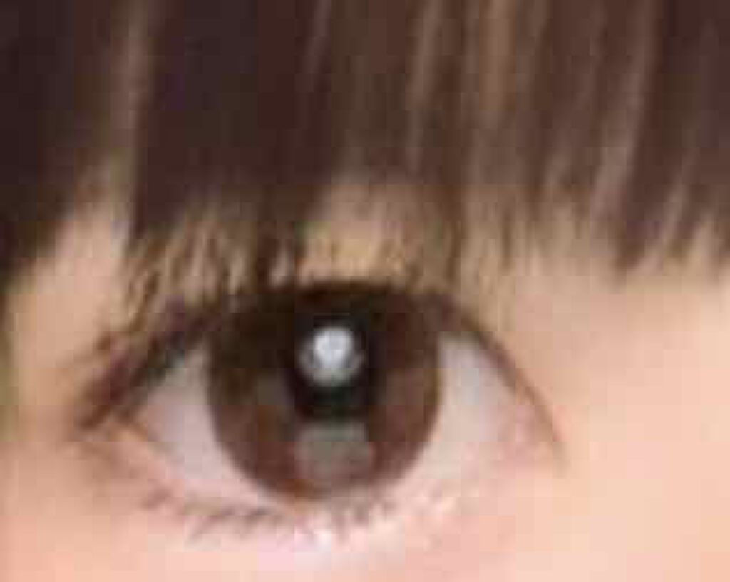 オロナインH軟膏 (医薬品)/オロナイン/その他を使ったクチコミ(2枚目)