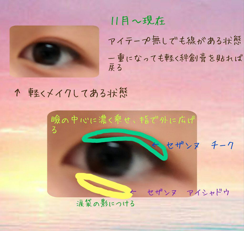 のびーるアイテープ（絆創膏タイプ、レギュラー）/DAISO/二重まぶた用アイテムを使ったクチコミ（3枚目）