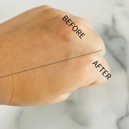 ãã³ã¯ãã£ãŒããªãŒã«ããŒã¯ãã·ã§ã³/APLIN/ã¯ãã·ã§ã³ãã¡ã³ããŒã·ã§ã³ã䜿ã£ãã¯ãã³ãïŒ4æç®ïŒ