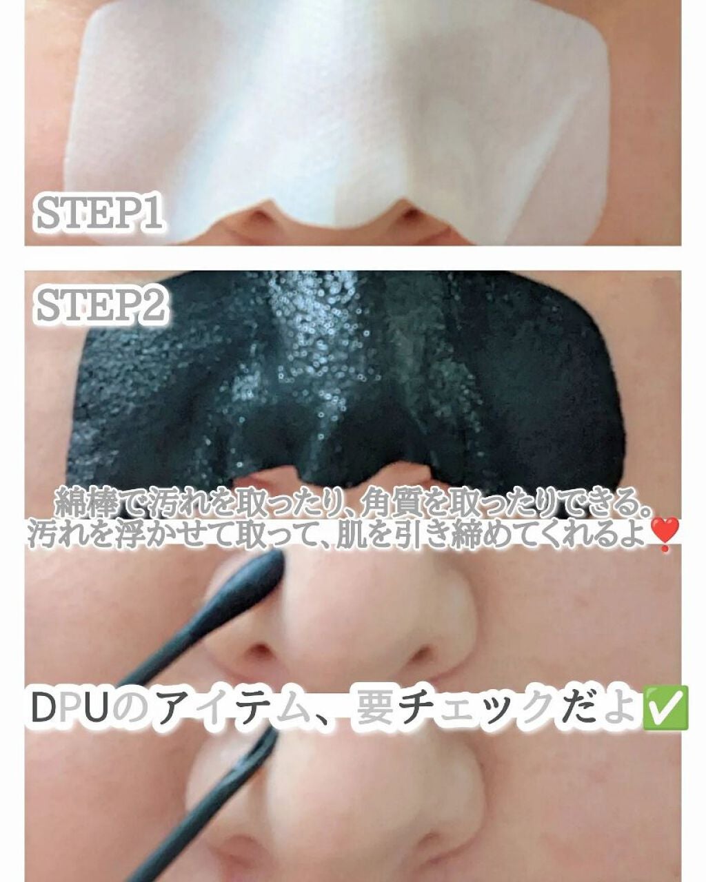ブラックヘッドクリア2ステップノーズパッチ/DPU/シートマスク・パックを使ったクチコミ(9枚目)