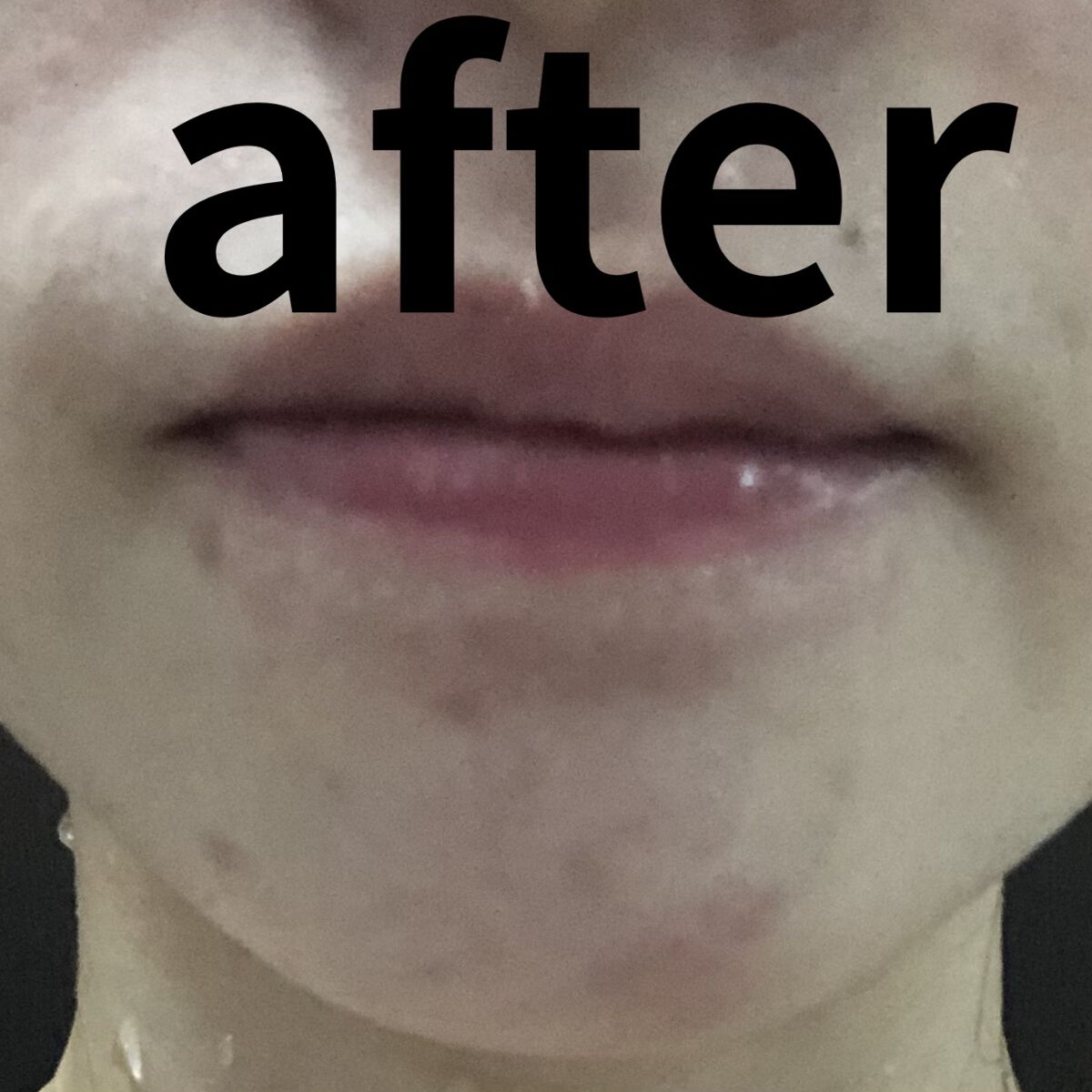 ドクダミ 77 スージングトナー/Anua/化粧水を使ったクチコミ（2枚目）