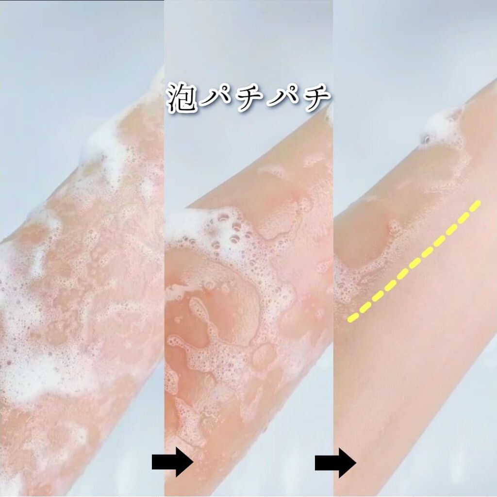 パチパチはたらくメイク落とし/ビオレ/クレンジングウォーターを使ったクチコミ(5枚目)