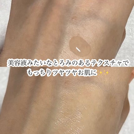 ブレッシングオブスプラウトラディアンストナー/HAYEJIN/化粧水を使ったクチコミ(4枚目)