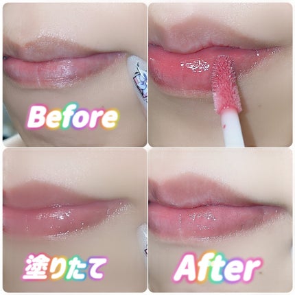 ニードルプランパー 高熱フィグ/Ui2./リッププランパーを使ったクチコミ(4枚目)