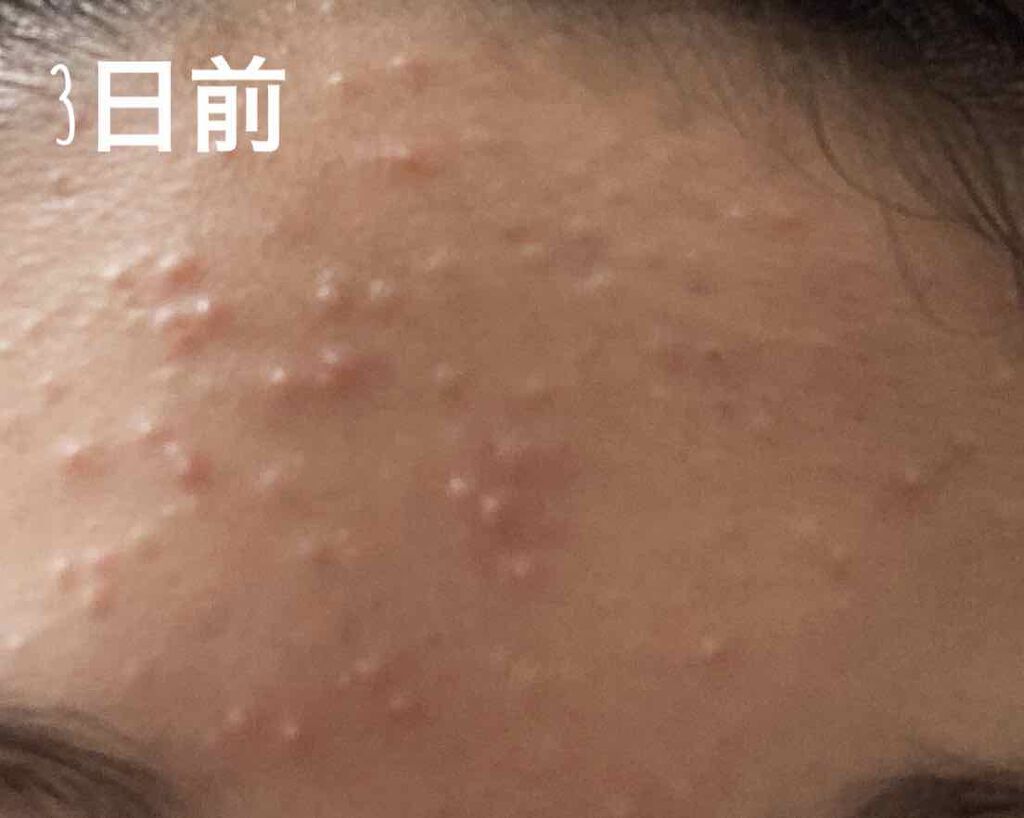 ハトムギ化粧水(ナチュリエ スキンコンディショナー R )/ナチュリエ/化粧水を使ったクチコミ（2枚目）