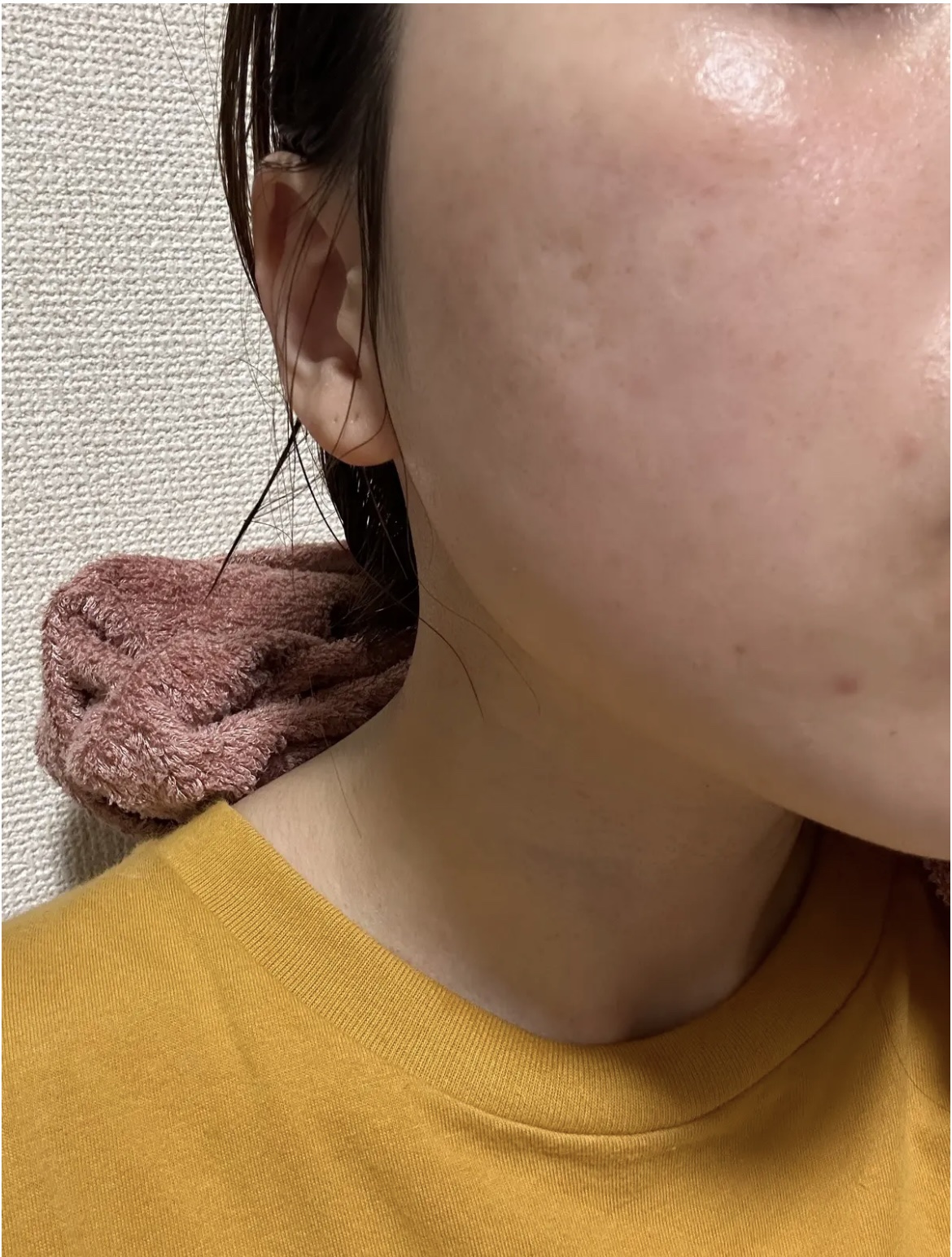 薬用しみ集中対策 プレミアム美容液/メラノCC/美容液を使ったクチコミ（1枚目）