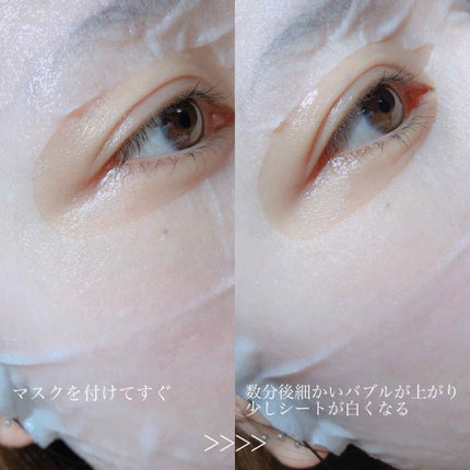 PEPTIDE VOLUME BUBBLE MASK/DR.PEPTI/シートマスク・パックを使ったクチコミ(3枚目)