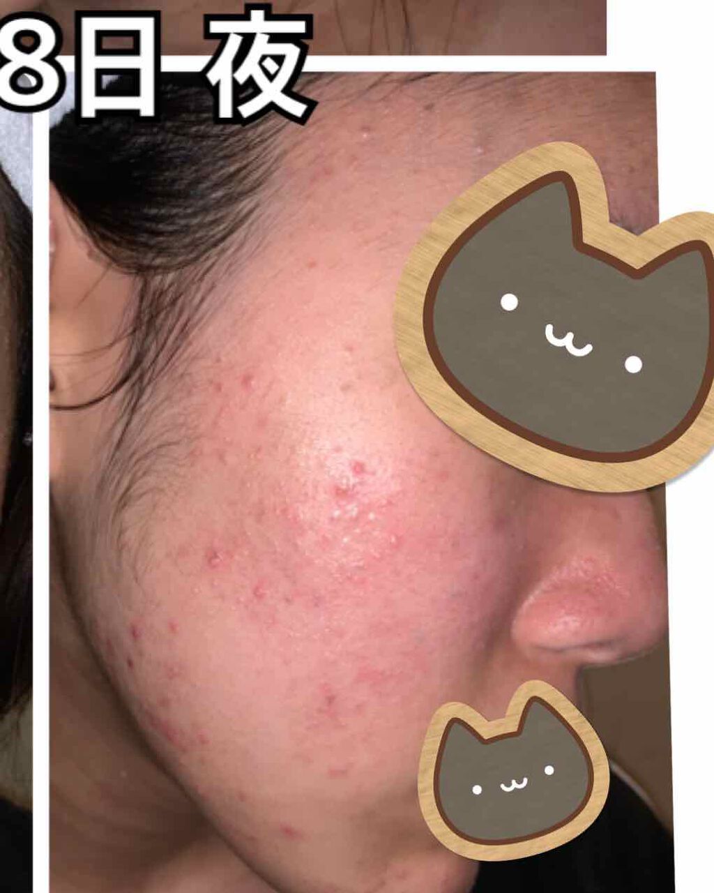 プロポリス エネルギーアンプル/CNP Laboratory/美容液を使ったクチコミ（3枚目）