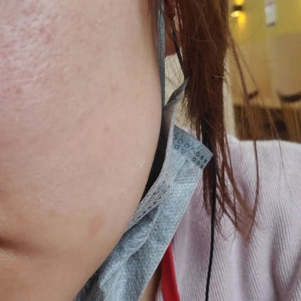 me on LIPS 「気になるニキビ無料診断で自分の肌タイプを診断させて頂きまし..」(7枚目)