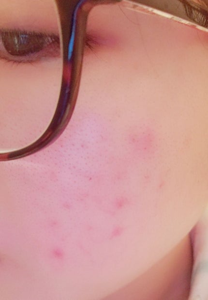 ロゼット 洗顔パスタ 荒性肌/ロゼット/洗顔フォームを使ったクチコミ(2枚目)