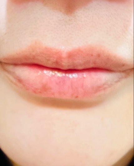 リップリビルダー /b.glen/リップケアを使ったクチコミ(3枚目)