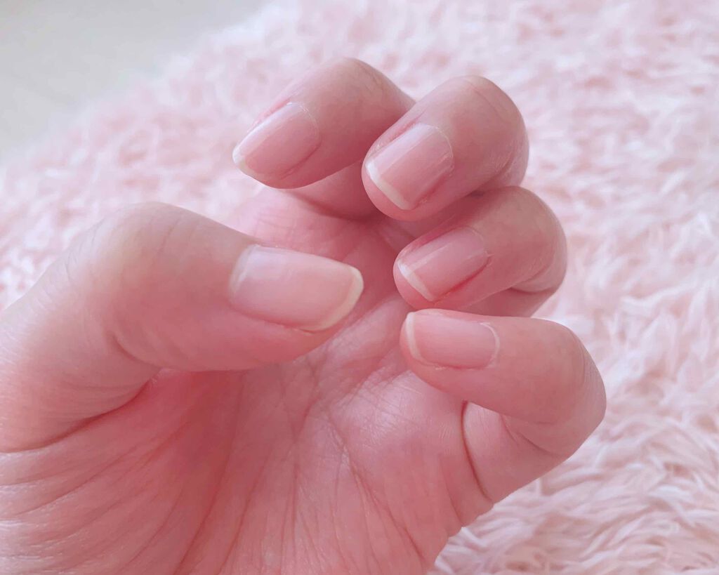 102ネイルコンシーラー/ジーニッシュマニキュア/ネイルオイル・トリートメントを使ったクチコミ(3枚目)