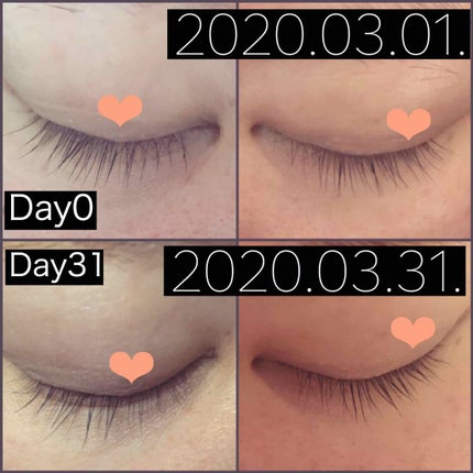 スカルプD ボーテ ピュアフリーアイラッシュセラム/アンファー(スカルプD)/まつげ美容液を使ったクチコミ(2枚目)