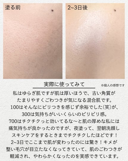 リードルショットシナジースパークリングトナーパッド/VT/トナーパッドを使ったクチコミ(4枚目)