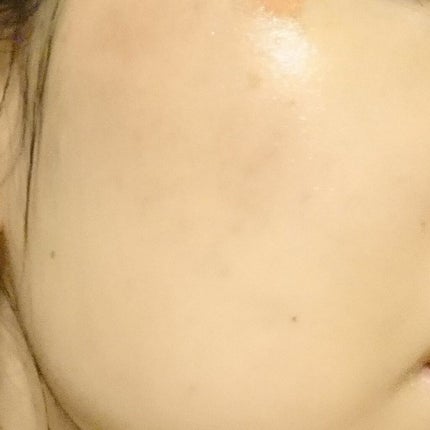 うるうるBOMBマスク/クリアターン/シートマスク・パックを使ったクチコミ(2枚目)