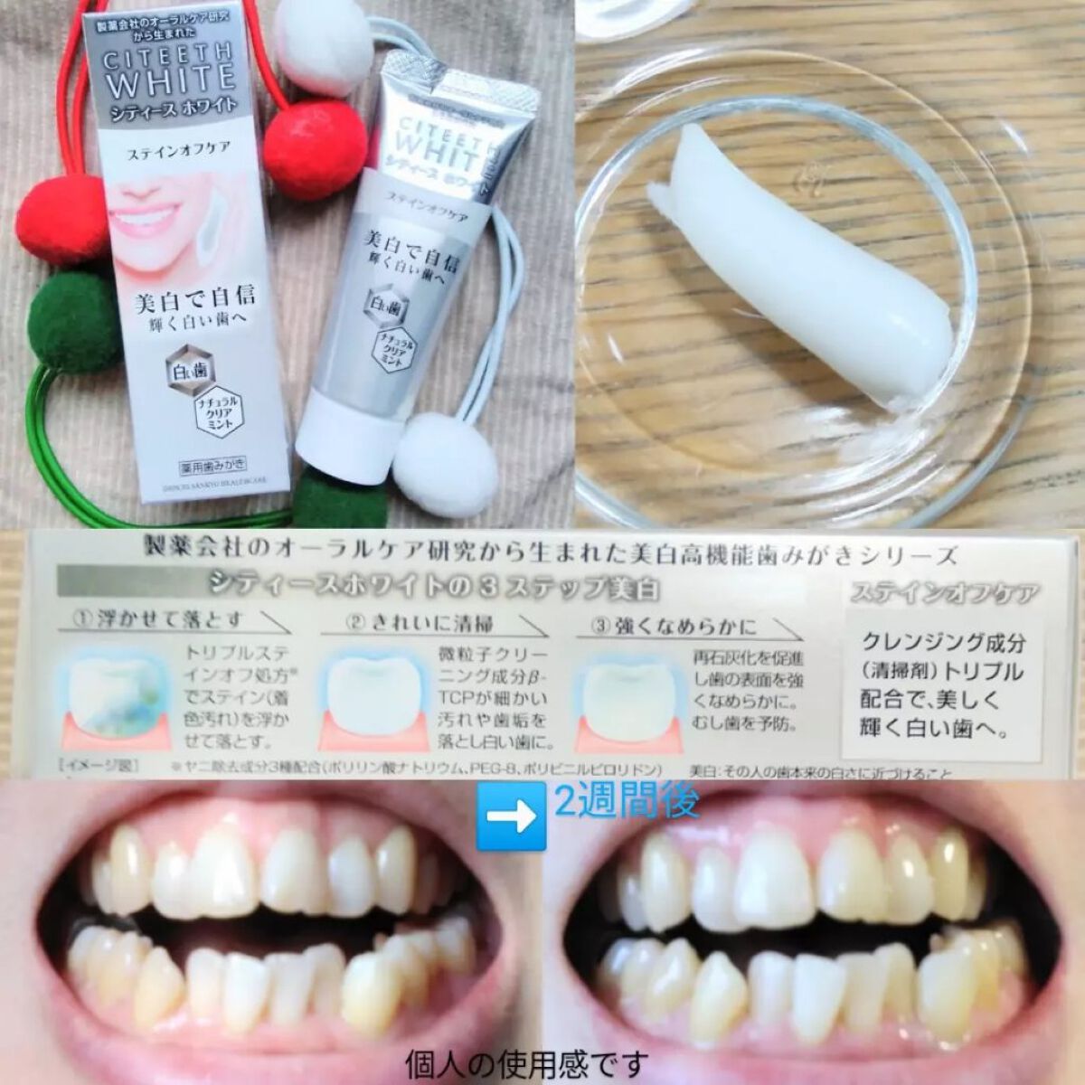 シティースホワイトステインオフケア/シティース/歯磨き粉を使ったクチコミ（2枚目）