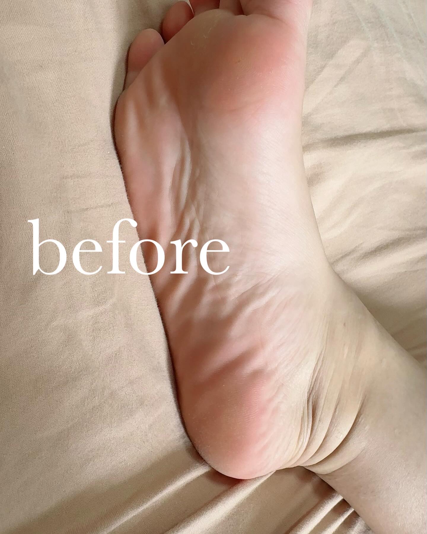 フットファイル/PERFECT NAILS/レッグ・フットケアを使ったクチコミ（3枚目）