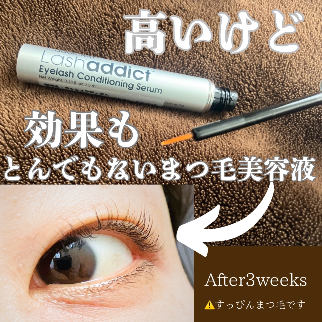 ラッシュアディクト アイラッシュコンディショニングセラム/soaddicted/まつげ美容液を使ったクチコミ（1枚目）