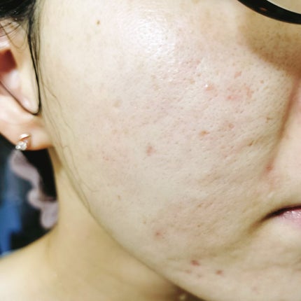 Alpha Arbutin 2% + HA/The Ordinary/フェイスオイルを使ったクチコミ(1枚目)