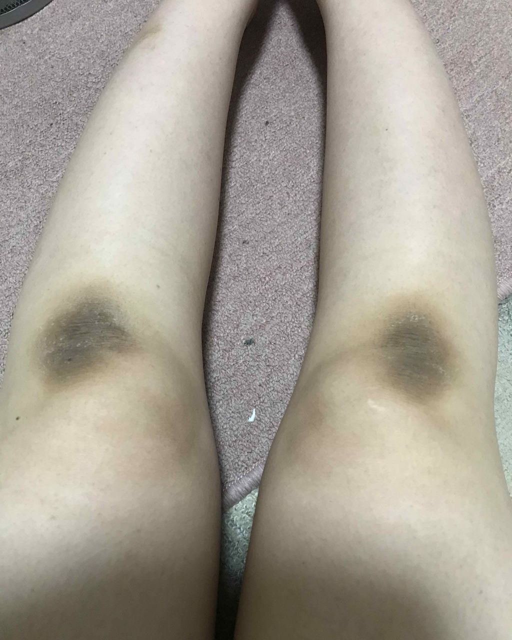 白ひざ姫/himecoto/レッグ・フットケアを使ったクチコミ（2枚目）