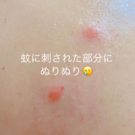 キュアプラス インテンシブ2Xクリーム/KIM JEONG MOON Aloe/フェイスバームを使ったクチコミ(7枚目)