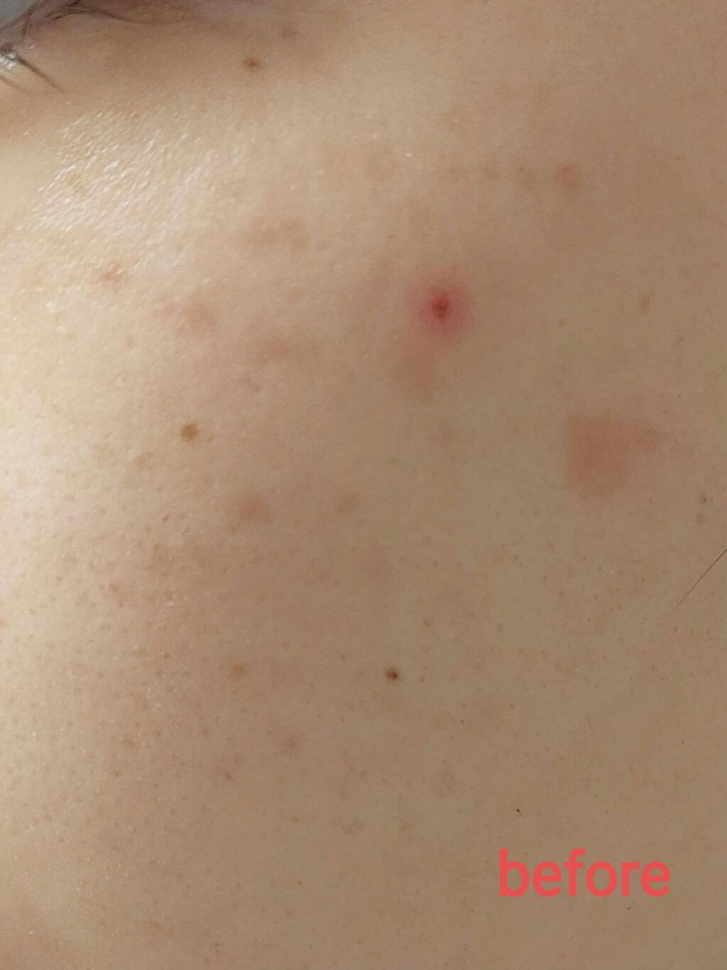 レチノールA 1% アドバンスドリバイタリゼーションクリーム/Life-flo/フェイスクリームを使ったクチコミ（2枚目）