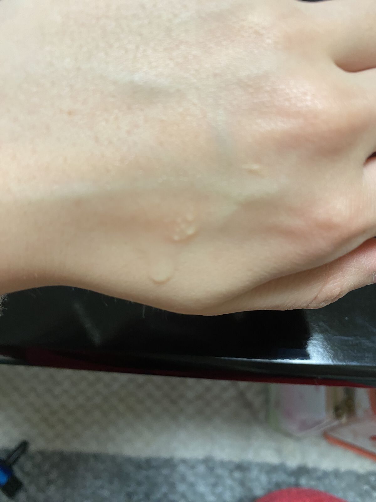 ブースト ポンパー X/アーレス/美容液を使ったクチコミ（1枚目）