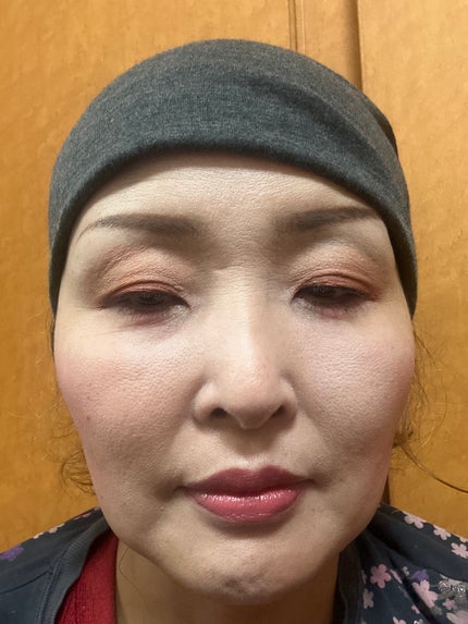 ブライトアップチークS/media/パウダーチークを使ったクチコミ(2枚目)