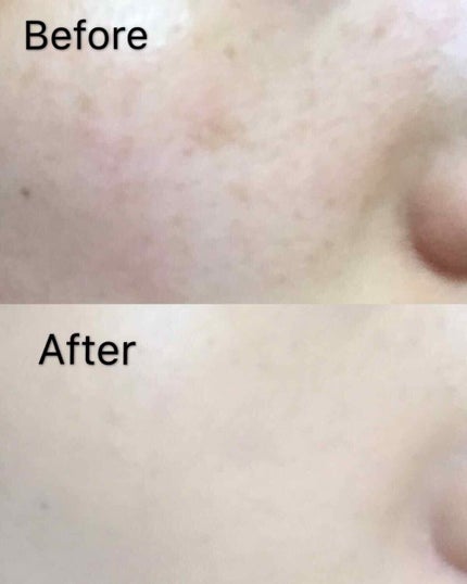 ミルキィフィットフルイド/excel/リキッドファンデーションを使ったクチコミ(2枚目)